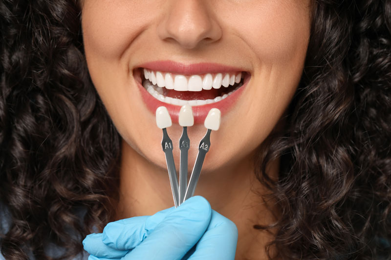 veneers in hand, women holding veneers, color matching to teeth