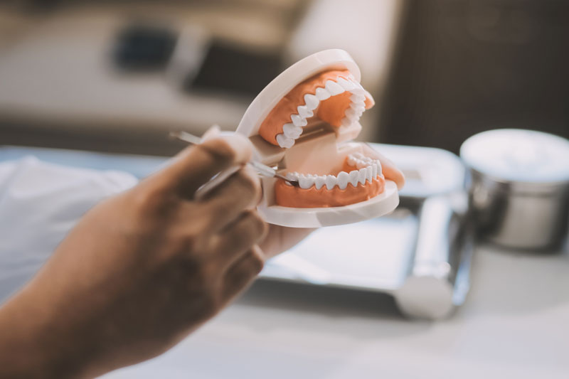 Discover how complete tooth implants restore function, aesthetics, and confidence. Learn about the process, benefits, and expert care. Schedule your consultation today!