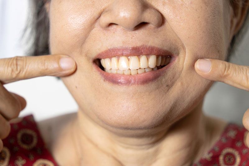 Elderly woman smiling and pointing to her new dentures, showcasing a full set of upper and lower artificial teeth.